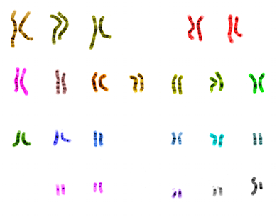 Kromosomerna hos en frisk människa. By HYanWong [CC0], via Wikimedia Commons